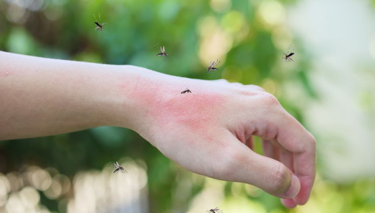 Il rimedio naturale sempre efficace contro le zanzare