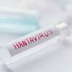 Hantavirus, allarme dopo il focolaio sulla nave da crociera: cosa sappiamo davvero sul virus